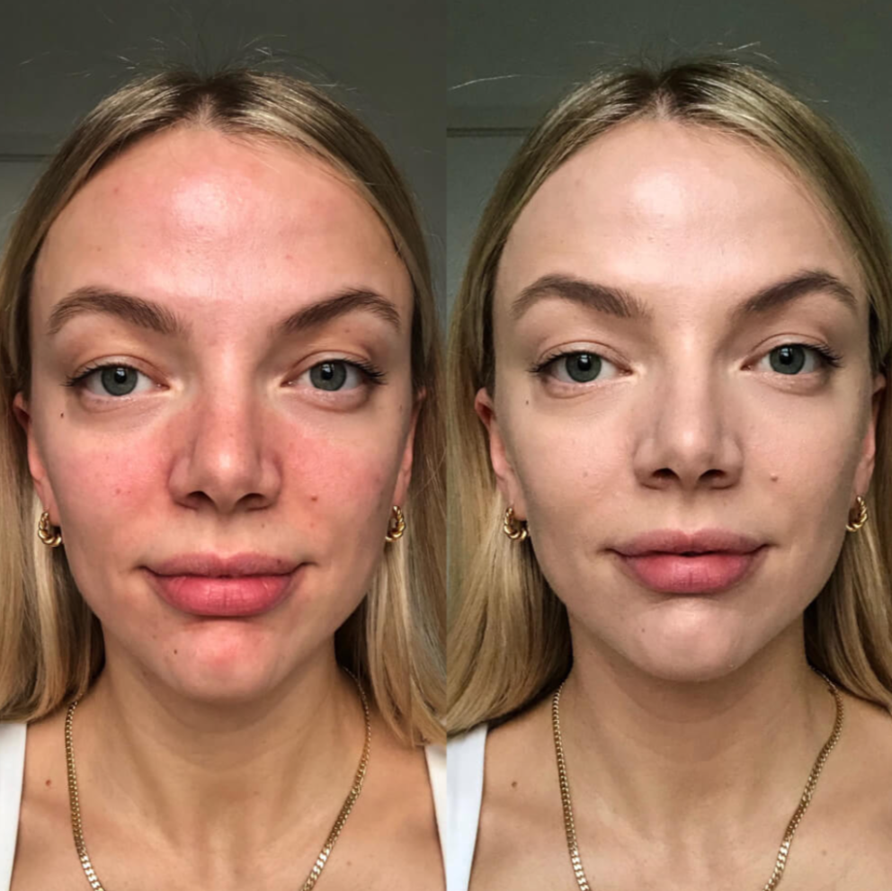 Lýsandi „fyrir og eftir“-mynd eftir ásetningu á Color Correcting Treatmentinu frá Dr. Jart+.