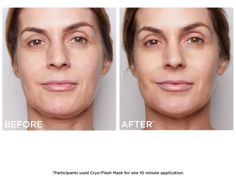 Fyrir og eftir að módelið leyfði Cryo-Flash Cream-maskanum að vera á húðinni í tíu mínútur.